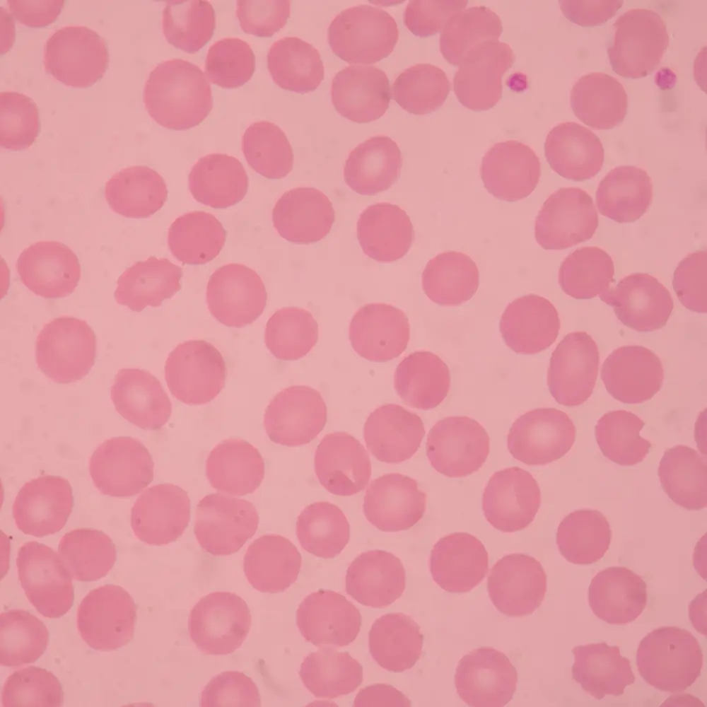 Blood Analysis